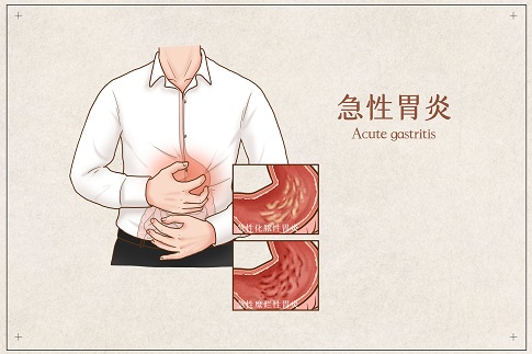 1656689842525012.jpg 攝圖網(wǎng)_401789692_banner_急性胃炎醫(yī)療插畫(huà)(企業(yè)商用).jpg